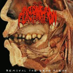 Anatomical Plastination : Removal the Dead Flesh